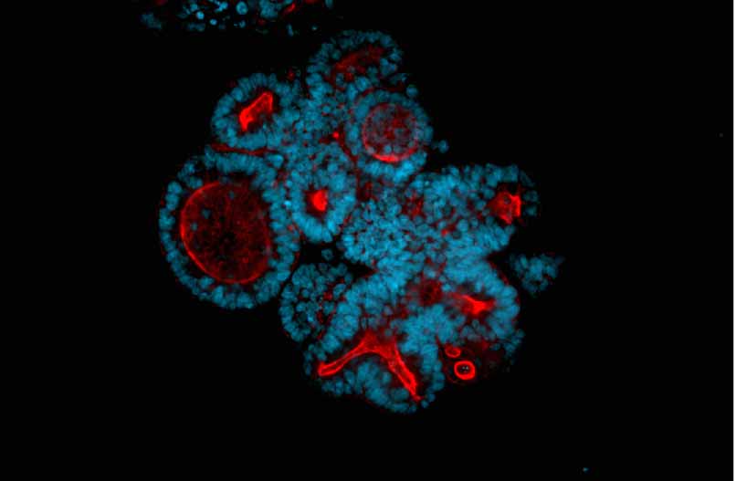 blue red organoid image (1) (1)